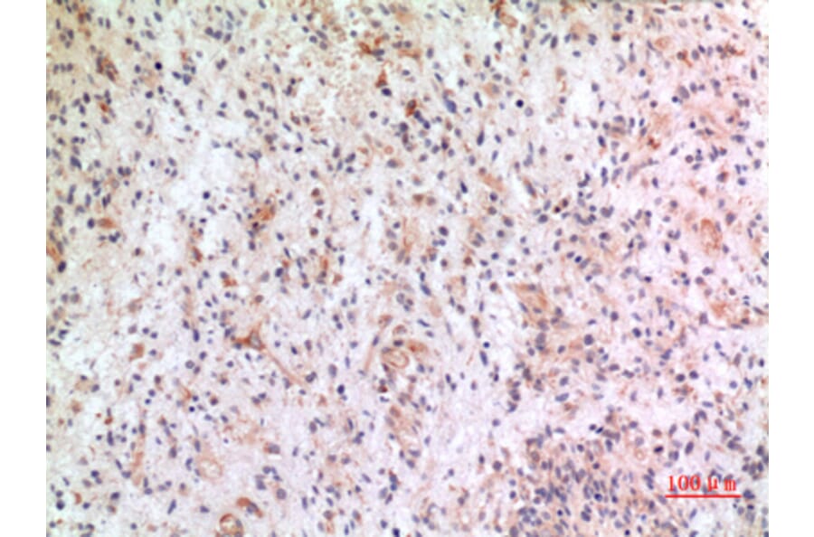 Immunohistochemistry - Anti-CX3CL1 Antibody (C30031) - Antibodies.com