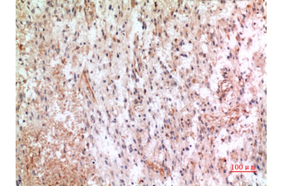Immunohistochemistry - Anti-CX3CL1 Antibody (C30031) - Antibodies.com