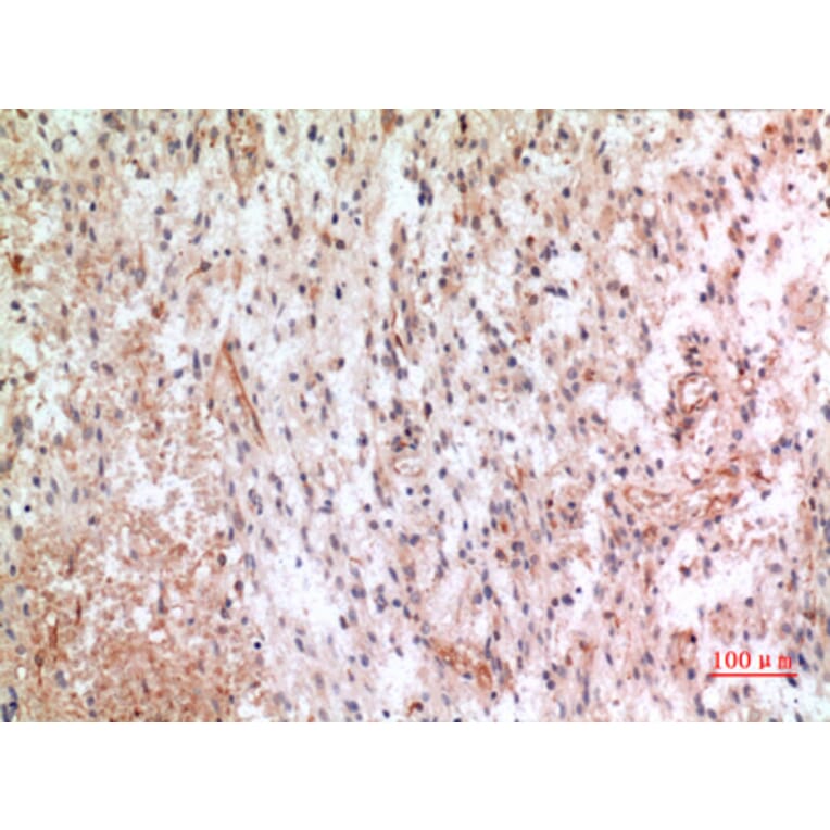 Immunohistochemistry - Anti-CX3CL1 Antibody (C30031) - Antibodies.com
