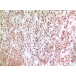 Immunohistochemistry - Anti-CX3CL1 Antibody (C30031) - Antibodies.com