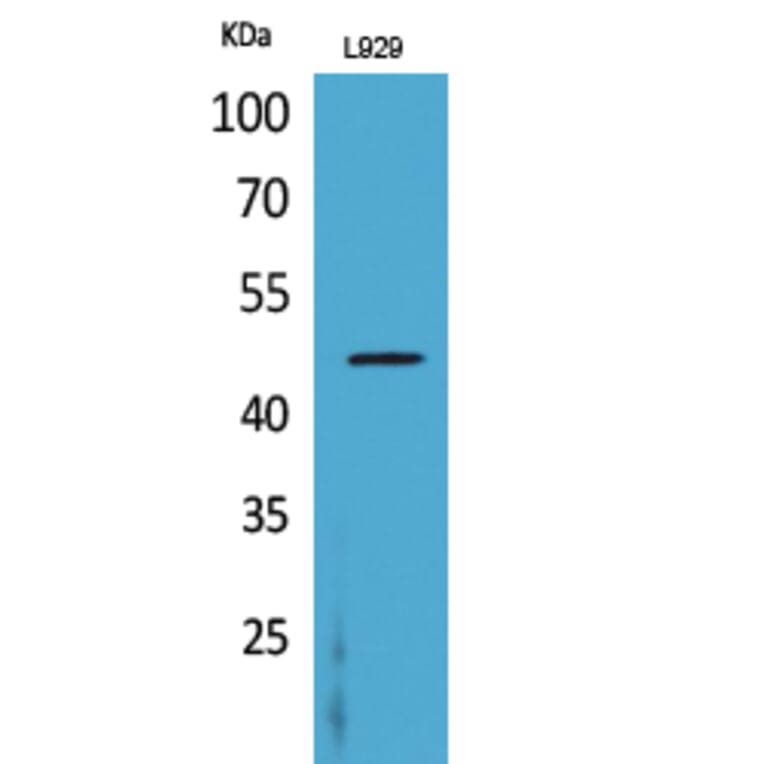 Western Blot - Anti-CSF2RA Antibody (C30419) - Antibodies.com