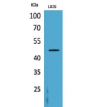 Western Blot - Anti-CSF2RA Antibody (C30419) - Antibodies.com