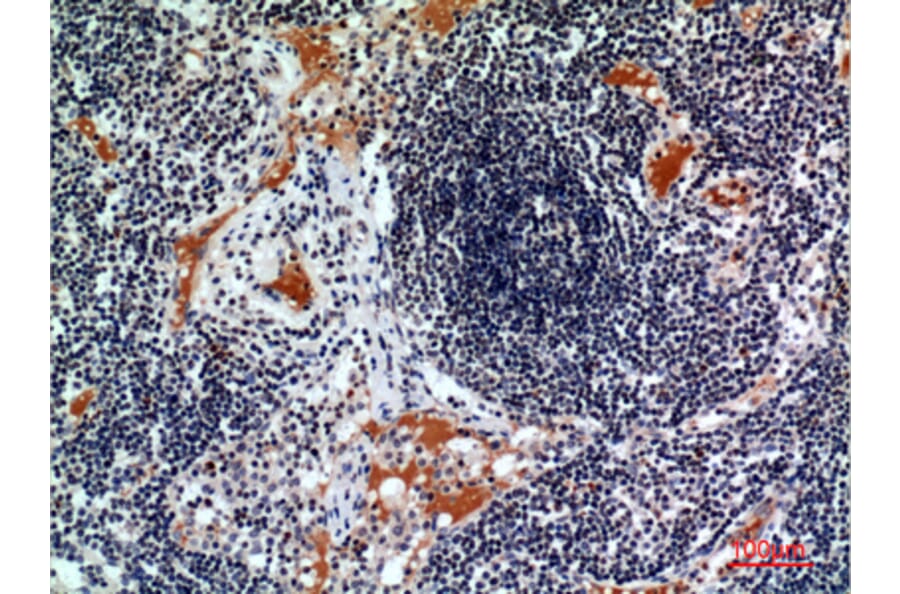 Immunohistochemistry - Anti-CSF2RA Antibody (C30419) - Antibodies.com