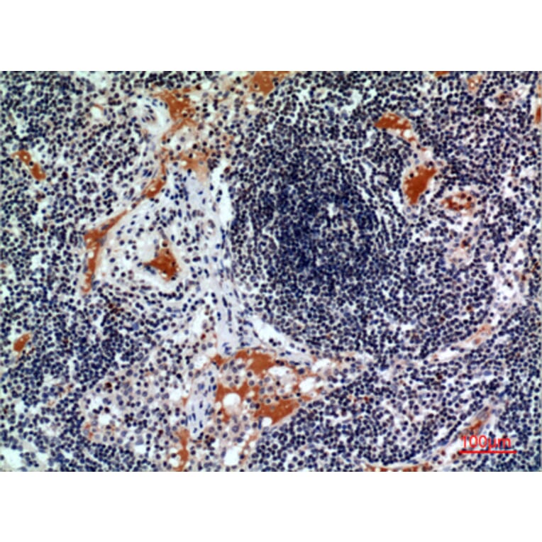 Immunohistochemistry - Anti-CSF2RA Antibody (C30419) - Antibodies.com