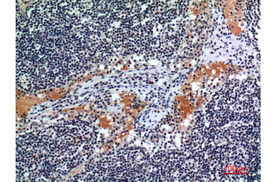 Immunohistochemistry - Anti-CSF2RA Antibody (C30419) - Antibodies.com