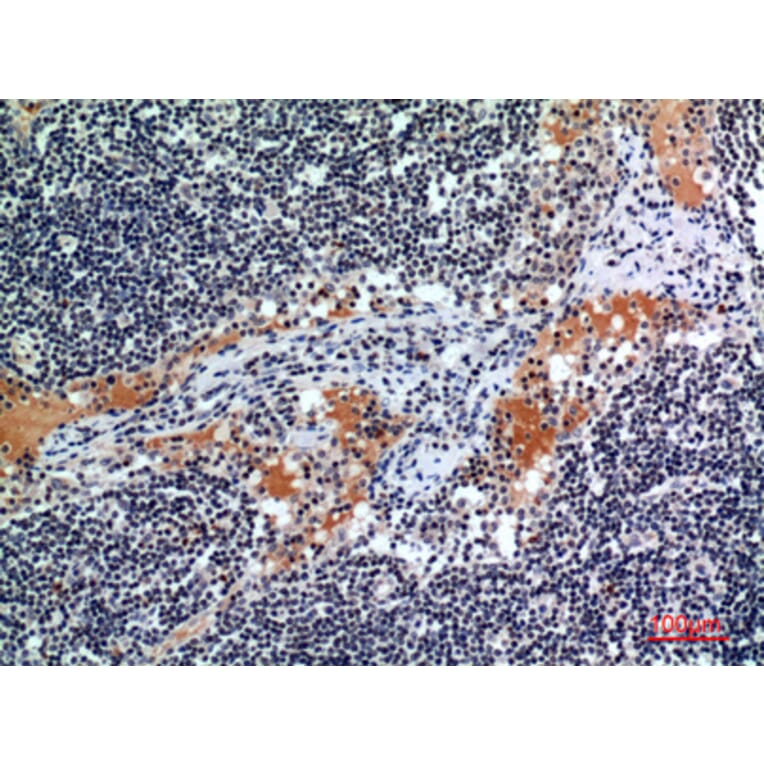 Immunohistochemistry - Anti-CSF2RA Antibody (C30419) - Antibodies.com