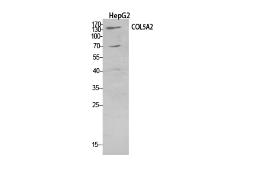 Western Blot - Anti-COL5A2 Antibody (C30980) - Antibodies.com