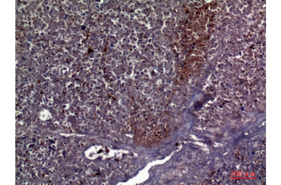 Immunohistochemistry - Anti-COL5A2 Antibody (C30980) - Antibodies.com