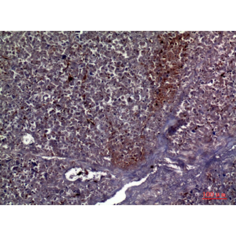 Immunohistochemistry - Anti-COL5A2 Antibody (C30980) - Antibodies.com
