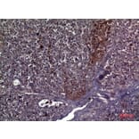 Immunohistochemistry - Anti-COL5A2 Antibody (C30980) - Antibodies.com