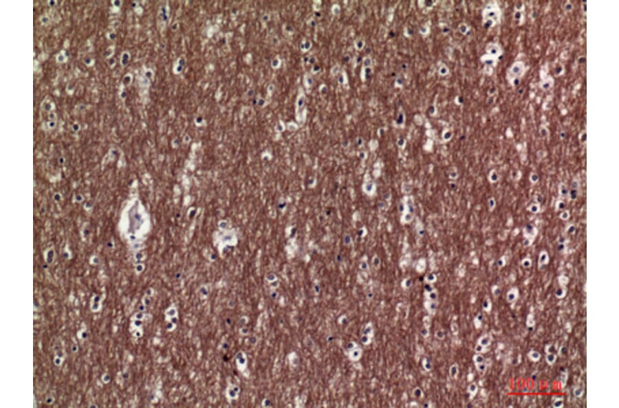 Immunohistochemistry - Anti-COL5A2 Antibody (C30980) - Antibodies.com
