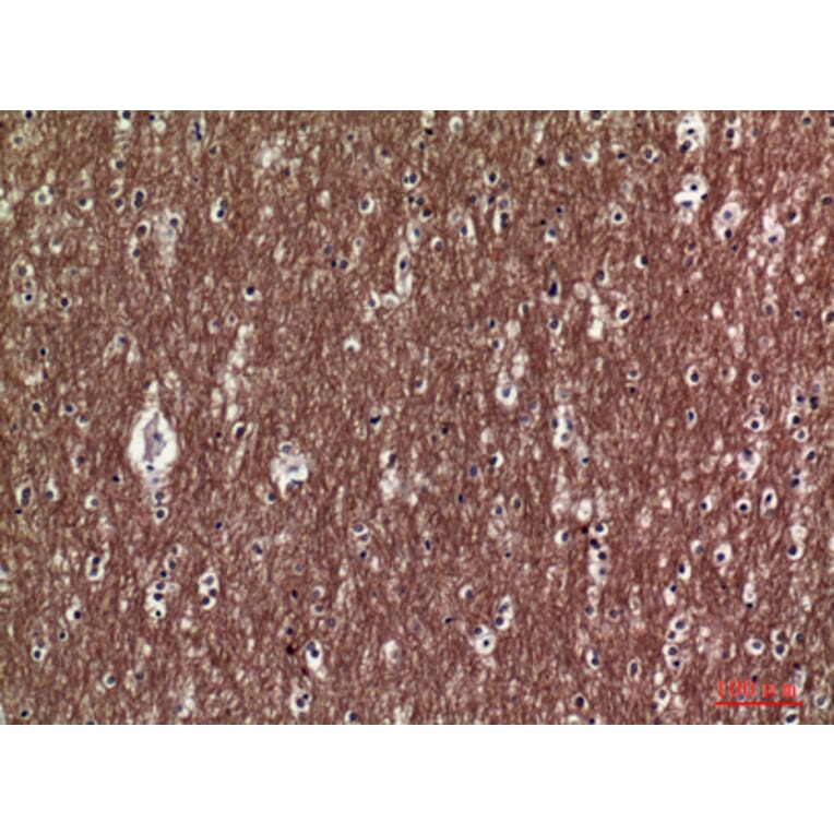 Immunohistochemistry - Anti-COL5A2 Antibody (C30980) - Antibodies.com