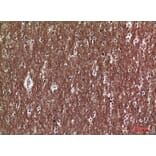 Immunohistochemistry - Anti-COL5A2 Antibody (C30980) - Antibodies.com