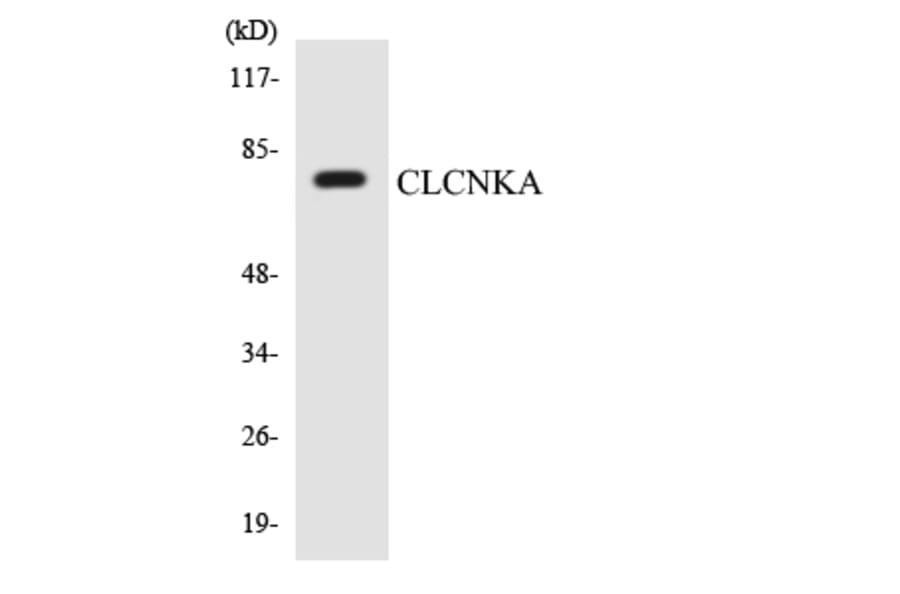 Western Blot - Anti-CLCNKA Antibody (R12-2626) - Antibodies.com