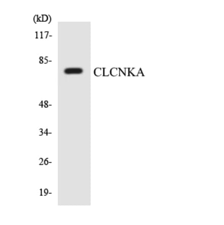 Western Blot - Anti-CLCNKA Antibody (R12-2626) - Antibodies.com