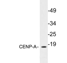 Western Blot - Anti-CENP-A Antibody (R12-2089) - Antibodies.com
