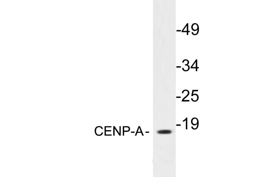 Western Blot - Anti-CENP-A Antibody (R12-2089) - Antibodies.com