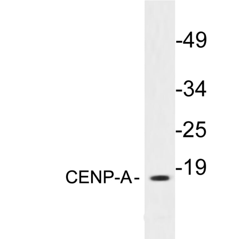Western Blot - Anti-CENP-A Antibody (R12-2089) - Antibodies.com