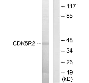 Western Blot - Anti-CDK5R2 Antibody (C10968) - Antibodies.com