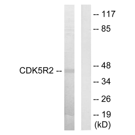 Western Blot - Anti-CDK5R2 Antibody (C10968) - Antibodies.com