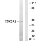 Western Blot - Anti-CDK5R2 Antibody (C10968) - Antibodies.com