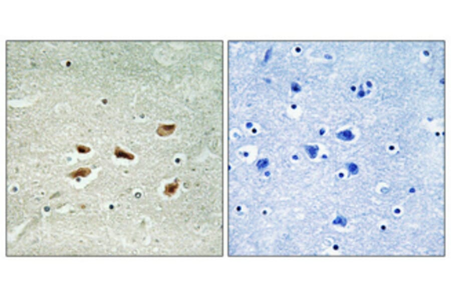 Immunohistochemistry - Anti-CDK5R2 Antibody (C10968) - Antibodies.com
