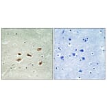 Immunohistochemistry - Anti-CDK5R2 Antibody (C10968) - Antibodies.com