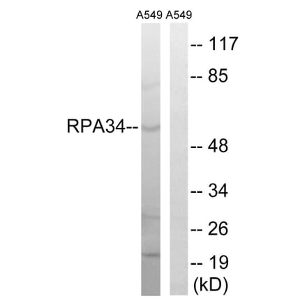 Western Blot - Anti-CD3EAP Antibody (C15463) - Antibodies.com