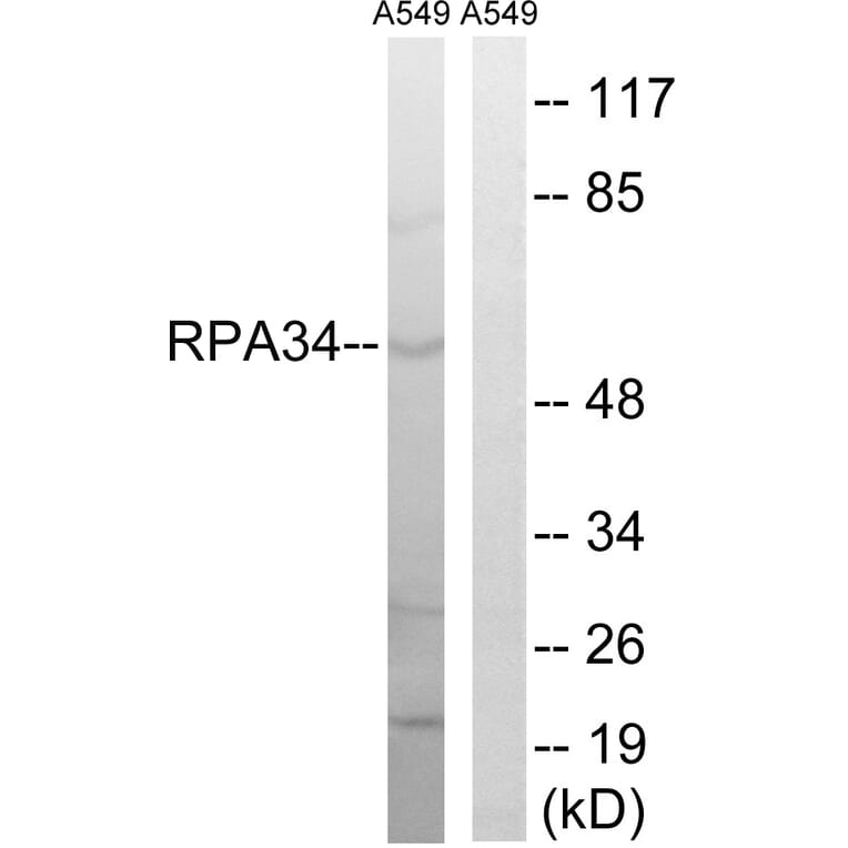 Western Blot - Anti-CD3EAP Antibody (C15463) - Antibodies.com