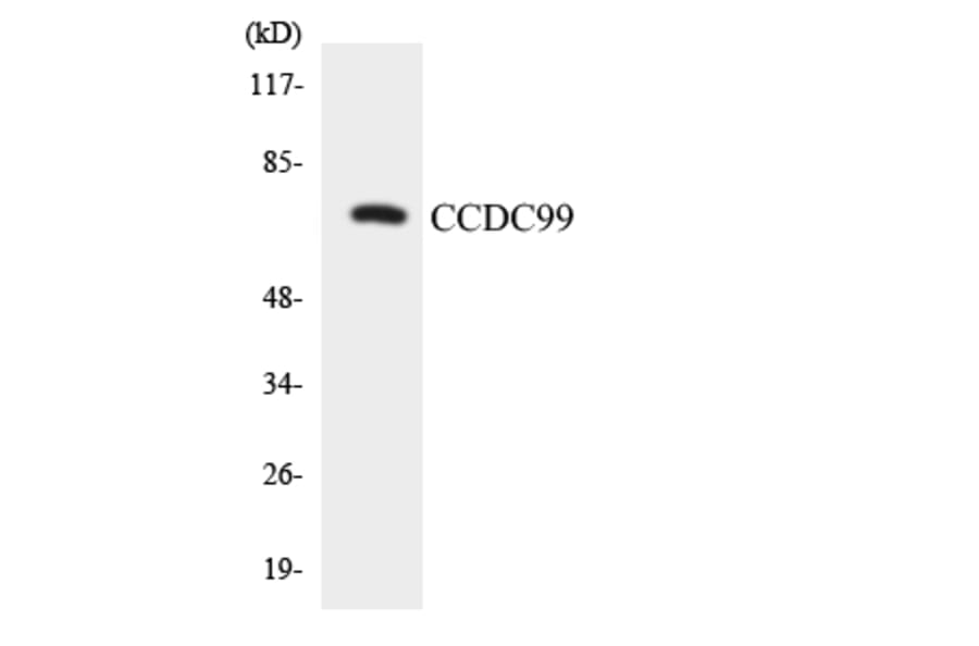Western Blot - Anti-CCDC99 Antibody (R12-2577) - Antibodies.com