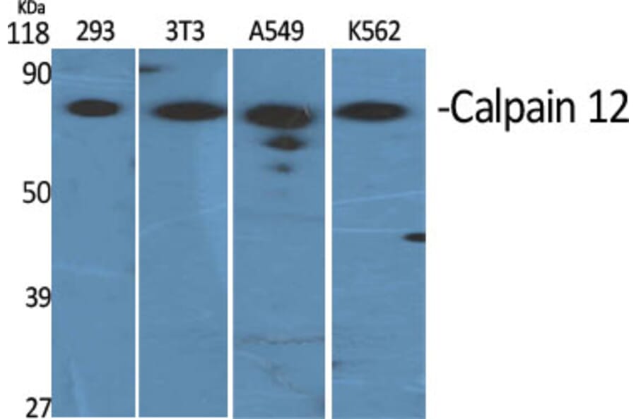 Western Blot - Anti-CAPN12 Antibody (C14870) - Antibodies.com