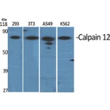 Western Blot - Anti-CAPN12 Antibody (C14870) - Antibodies.com