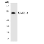 Western Blot - Anti-CAPN12 Antibody (R12-2568) - Antibodies.com