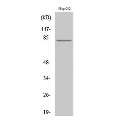 Western Blot - Anti-CAPN11 Antibody (C14869) - Antibodies.com