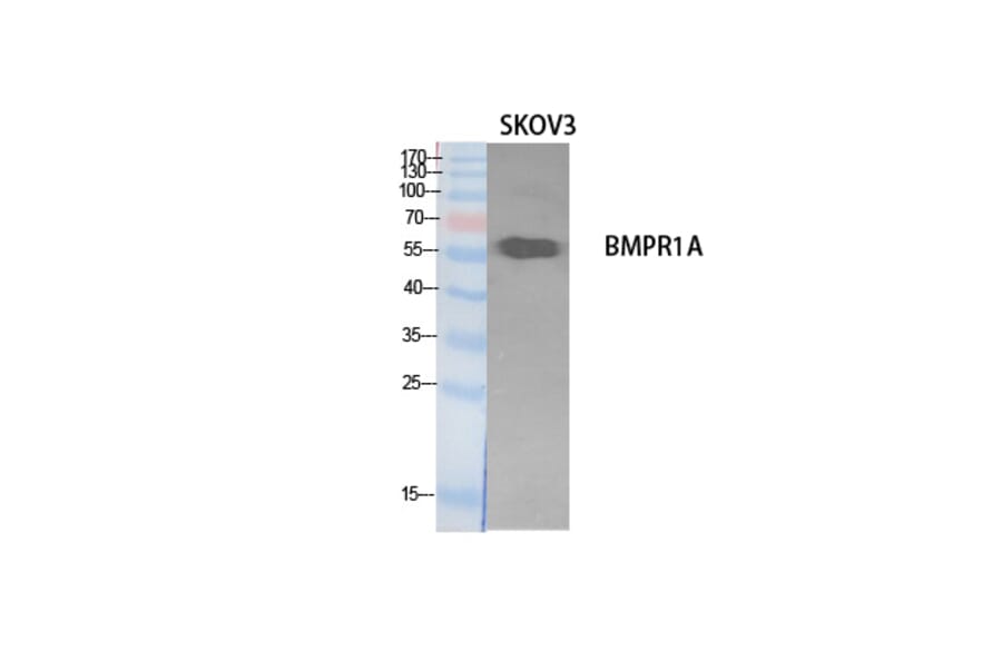 Western Blot - Anti-BMPR1A Antibody (C30487) - Antibodies.com