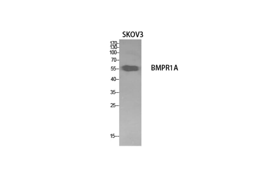 Western Blot - Anti-BMPR1A Antibody (C30487) - Antibodies.com