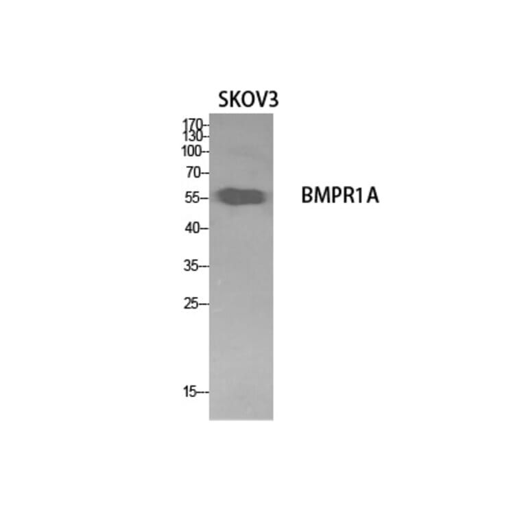 Western Blot - Anti-BMPR1A Antibody (C30487) - Antibodies.com