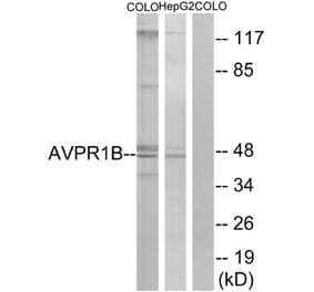 Western Blot - Anti-AVPR1B Antibody (G787) - Antibodies.com