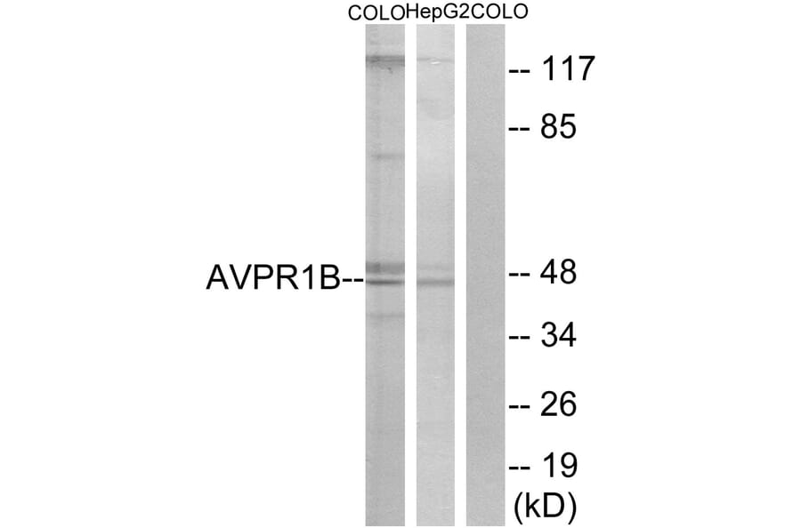 Western Blot - Anti-AVPR1B Antibody (G787) - Antibodies.com