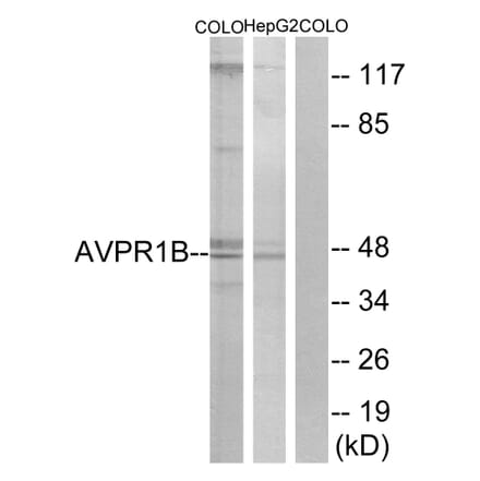 Western Blot - Anti-AVPR1B Antibody (G787) - Antibodies.com