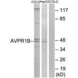 Western Blot - Anti-AVPR1B Antibody (G787) - Antibodies.com