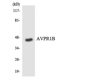 Western Blot - Anti-AVPR1B Antibody (R12-2526) - Antibodies.com