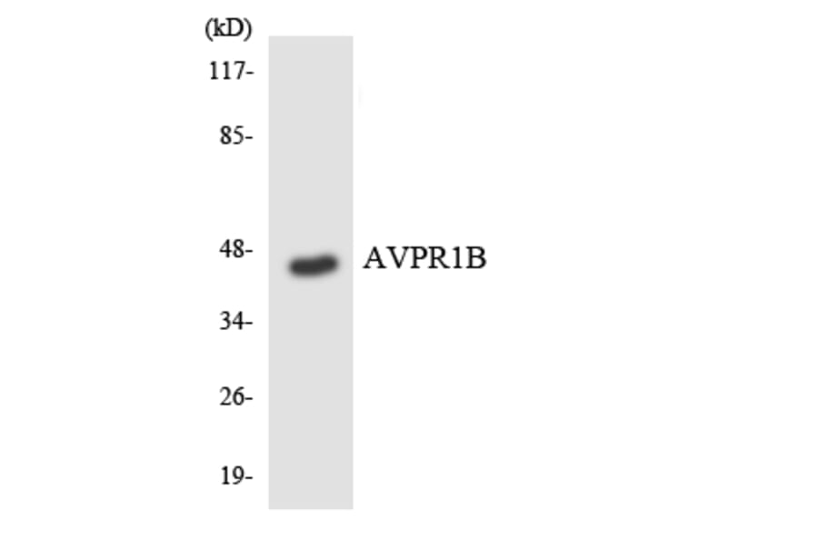 Western Blot - Anti-AVPR1B Antibody (R12-2526) - Antibodies.com