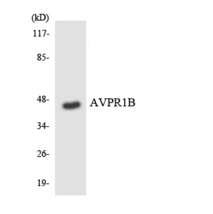 Western Blot - Anti-AVPR1B Antibody (R12-2526) - Antibodies.com