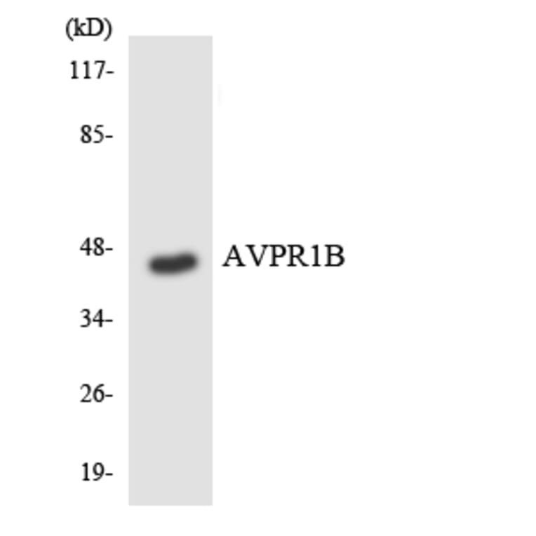 Western Blot - Anti-AVPR1B Antibody (R12-2526) - Antibodies.com