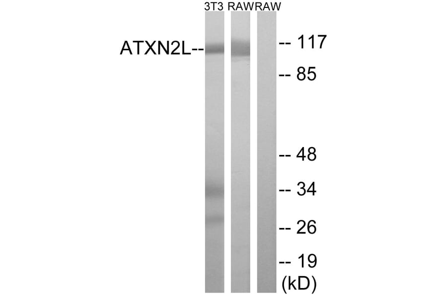 Western Blot - Anti-ATXN2L Antibody (C14580) - Antibodies.com