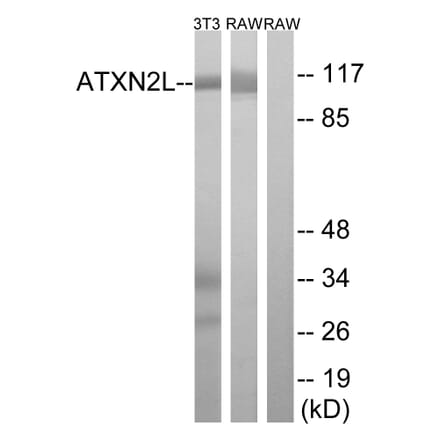 Western Blot - Anti-ATXN2L Antibody (C14580) - Antibodies.com