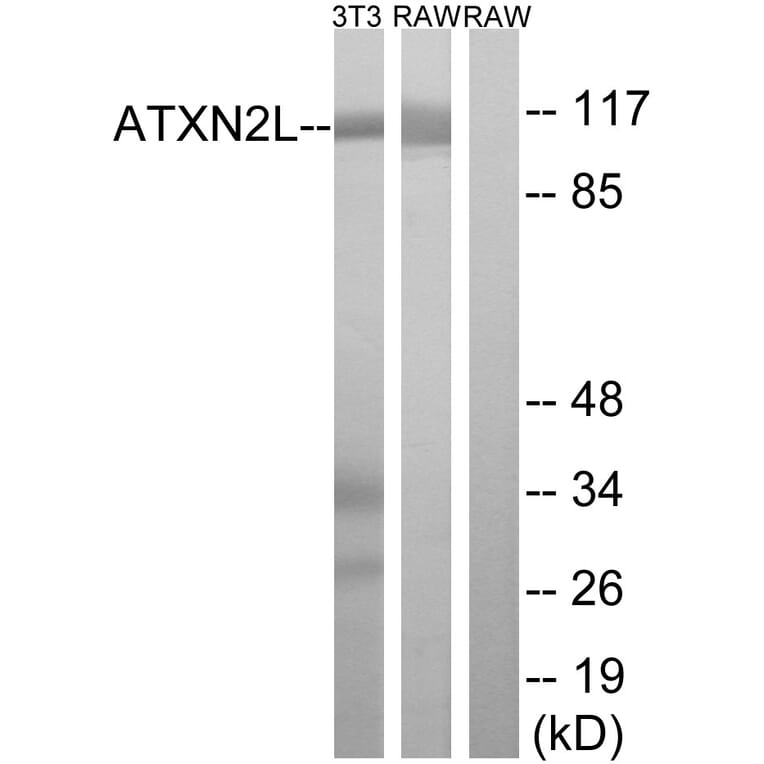 Western Blot - Anti-ATXN2L Antibody (C14580) - Antibodies.com
