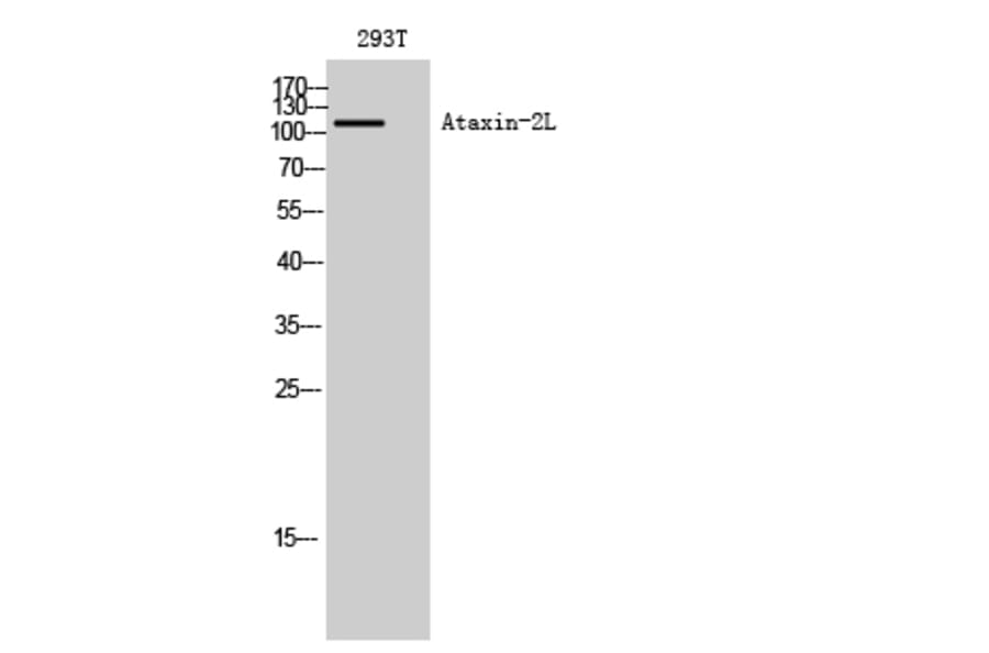 Western Blot - Anti-ATXN2L Antibody (C14580) - Antibodies.com