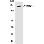 Western Blot - Anti-ATXN2L Antibody (R12-2524) - Antibodies.com